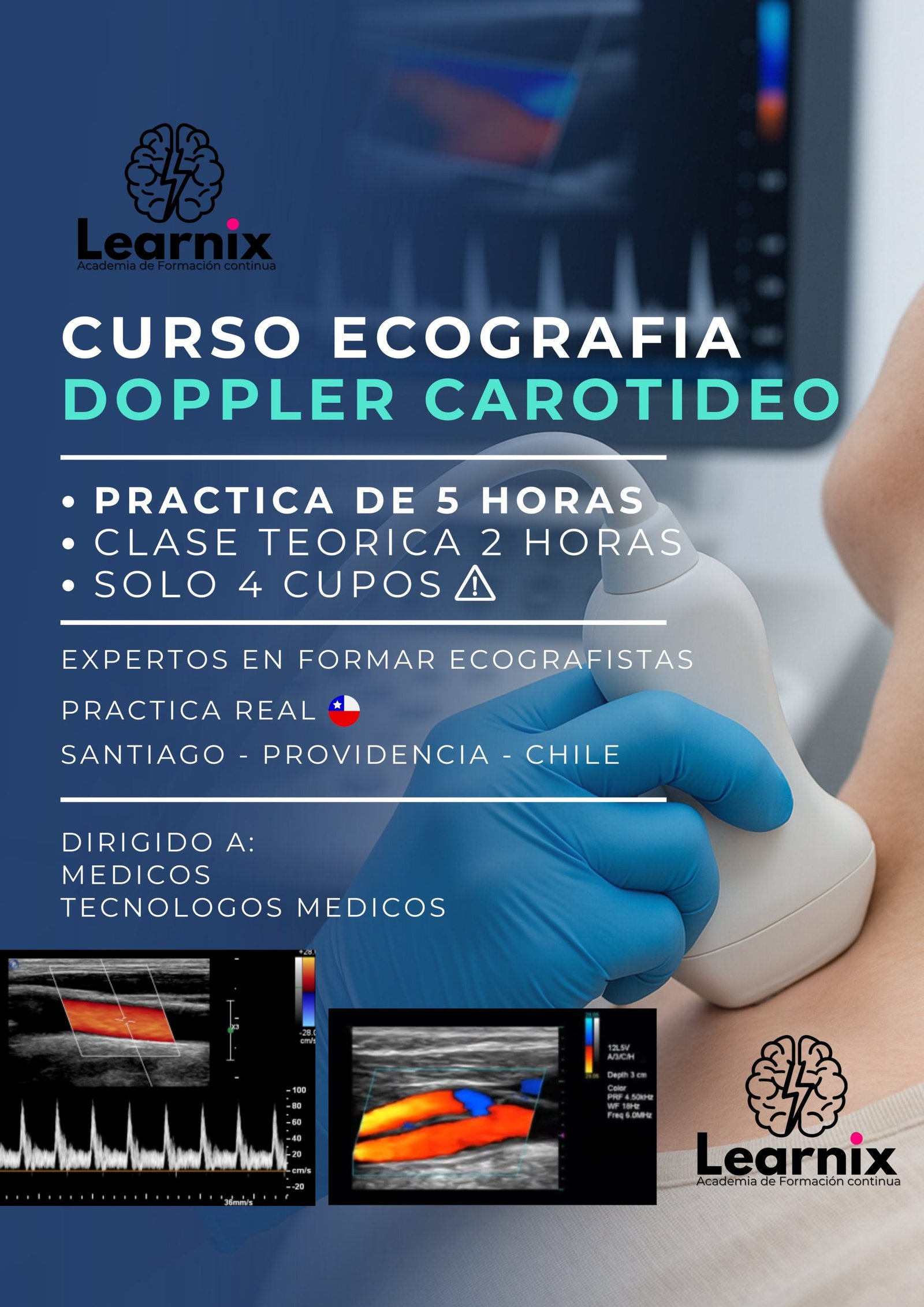 Ecografía Doppler Carotideo