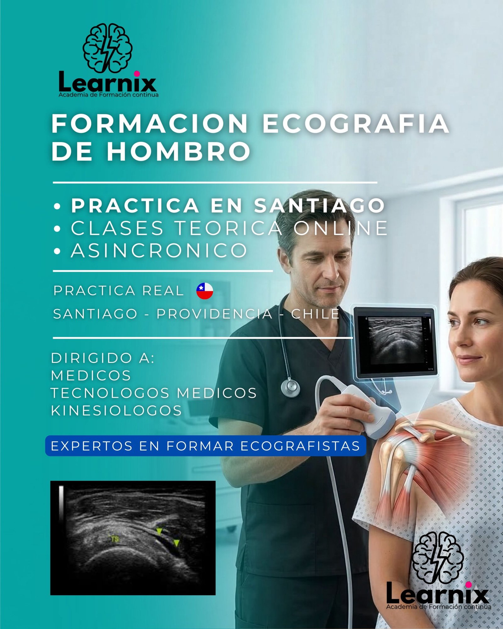 ECOGRAFIA HOMBRO