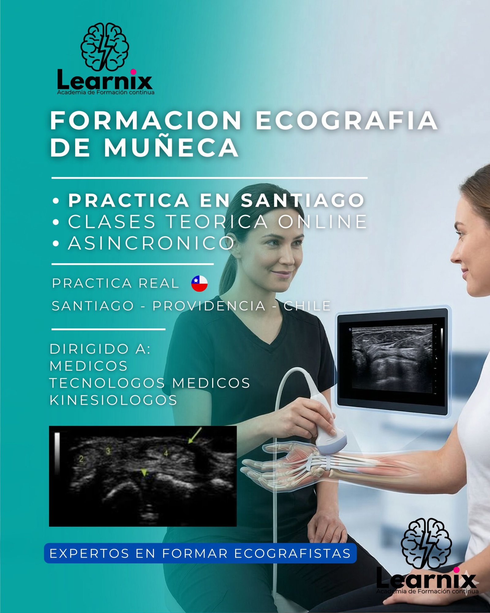 ECOGRAFIA MUÑECA